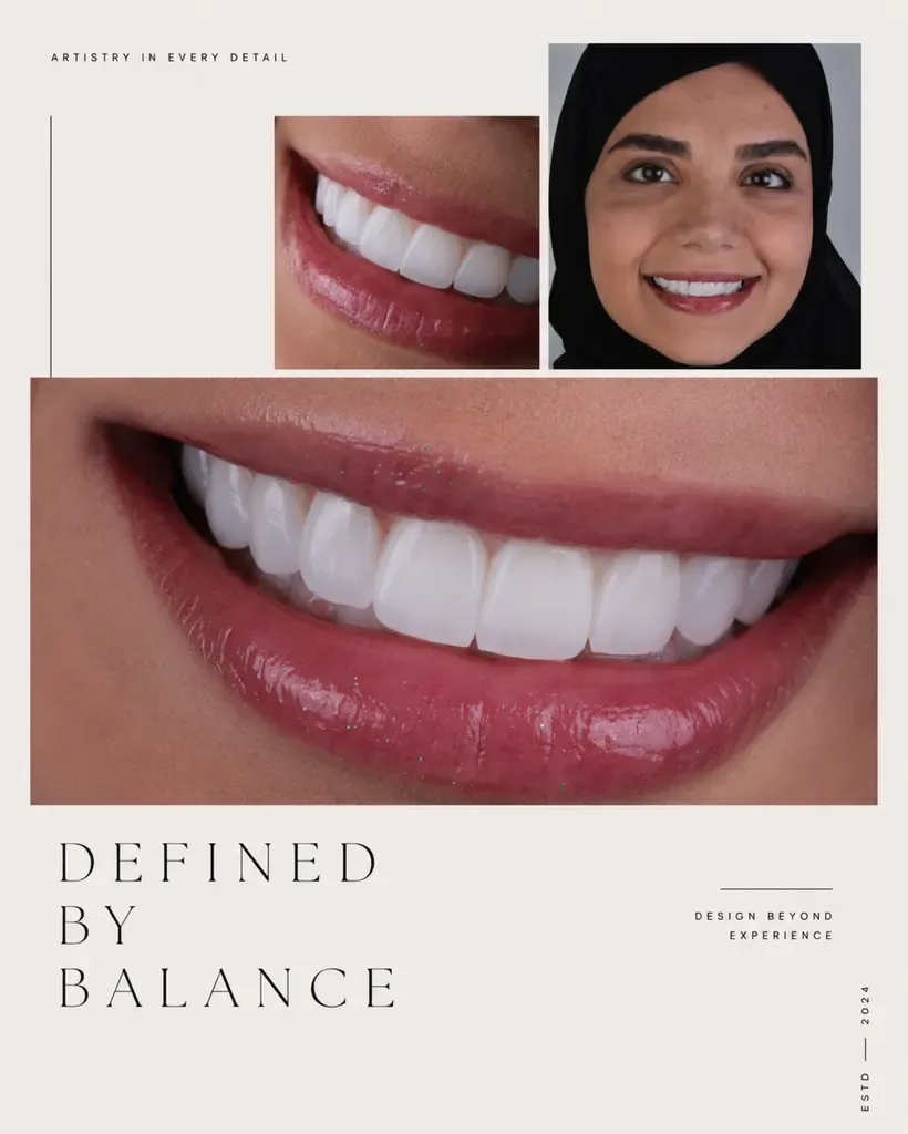 تعادل و تقارن لبخند — نمونه‌کار دندانپزشکی دماوند